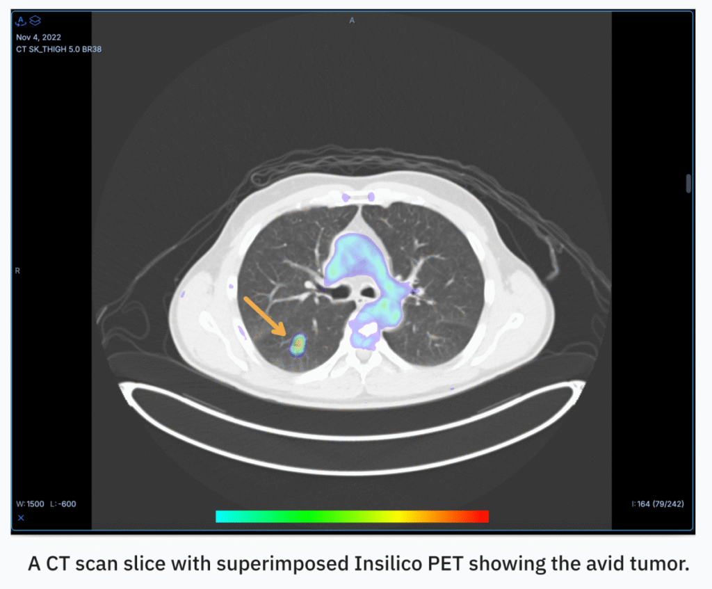 Oxford spinout RADiCAIT uses AI to make diagnostic imaging more affordable and accessible — see us at TechCrunch Disrupt 2025